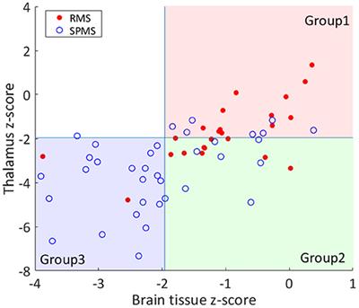 Thalamic Atrophy Without Whole Brain Atrophy Is Associated With Absence of 2-Year NEDA in Multiple Sclerosis